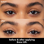 Brow Lift